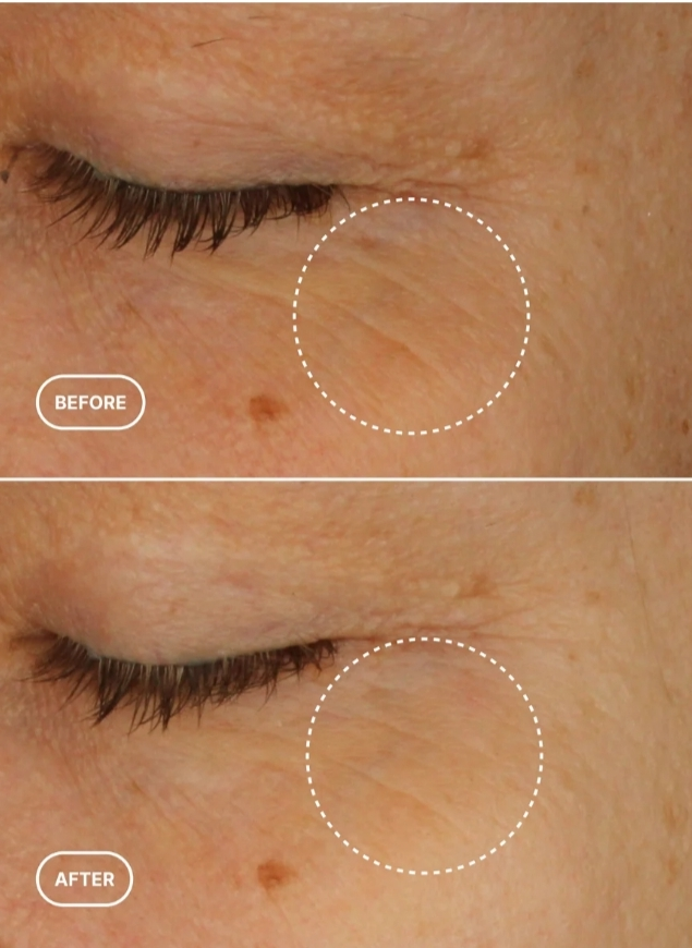 Retinol Alternative Eye Serum