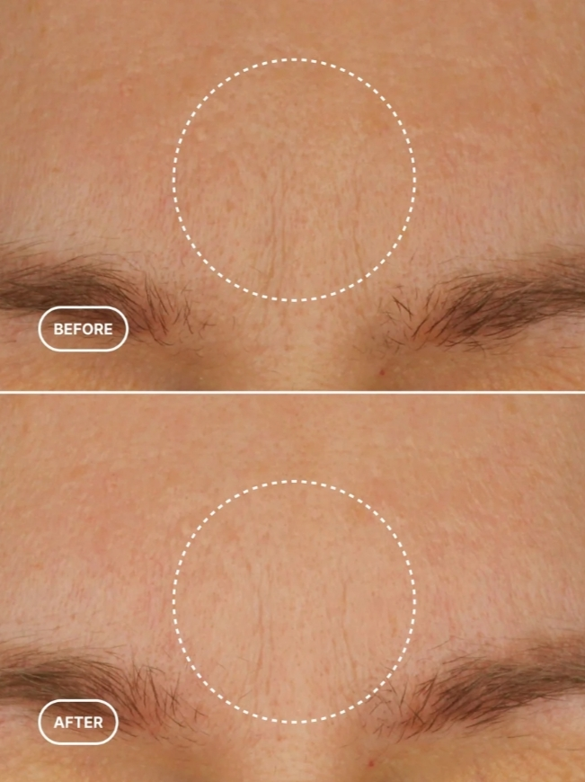 Retinol Alternative Moisturizer